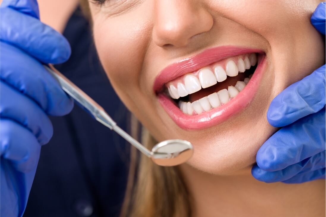 How Do Full Mouth Dental Implants Work